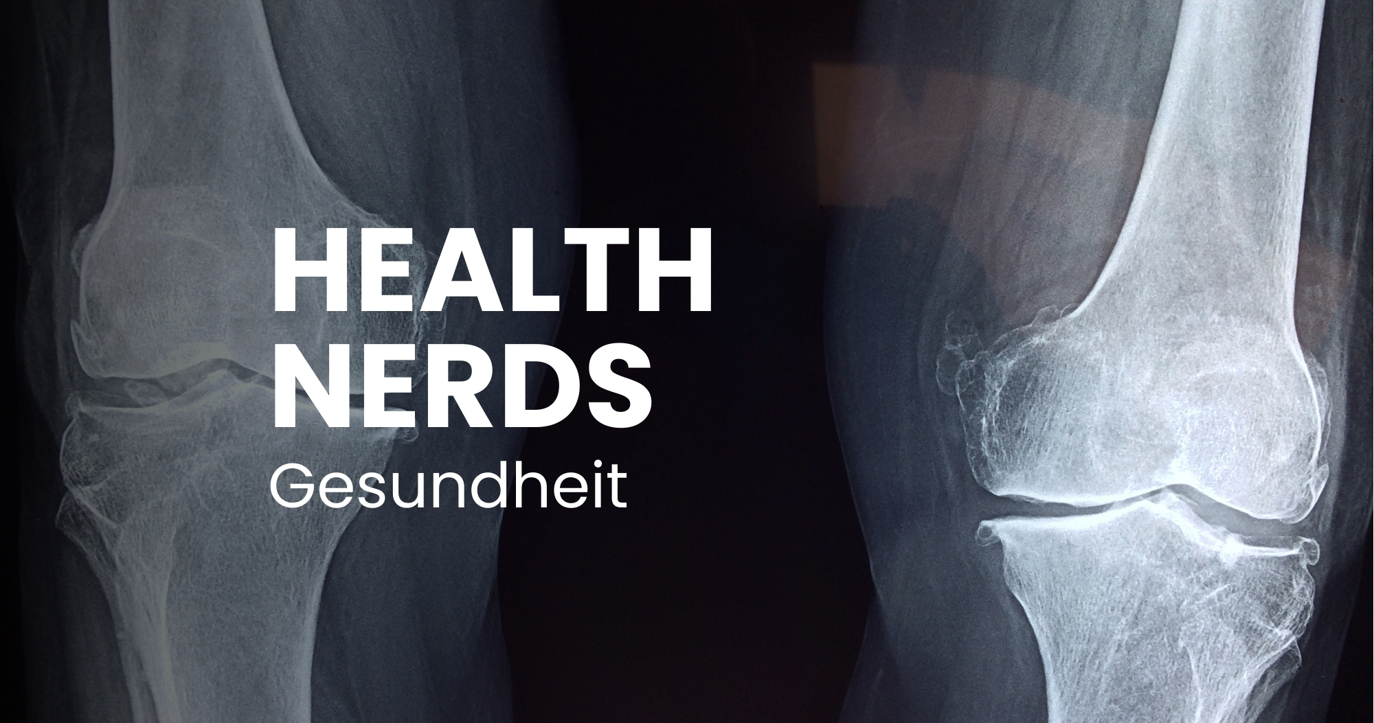 Unser Knochengerüst und Skelettsystem: keine tote Materie, sondern lebendige, hochaktive Zellen