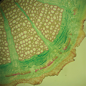 Resveratrol Longevity Bild zu BMT® technology for maximum absorption