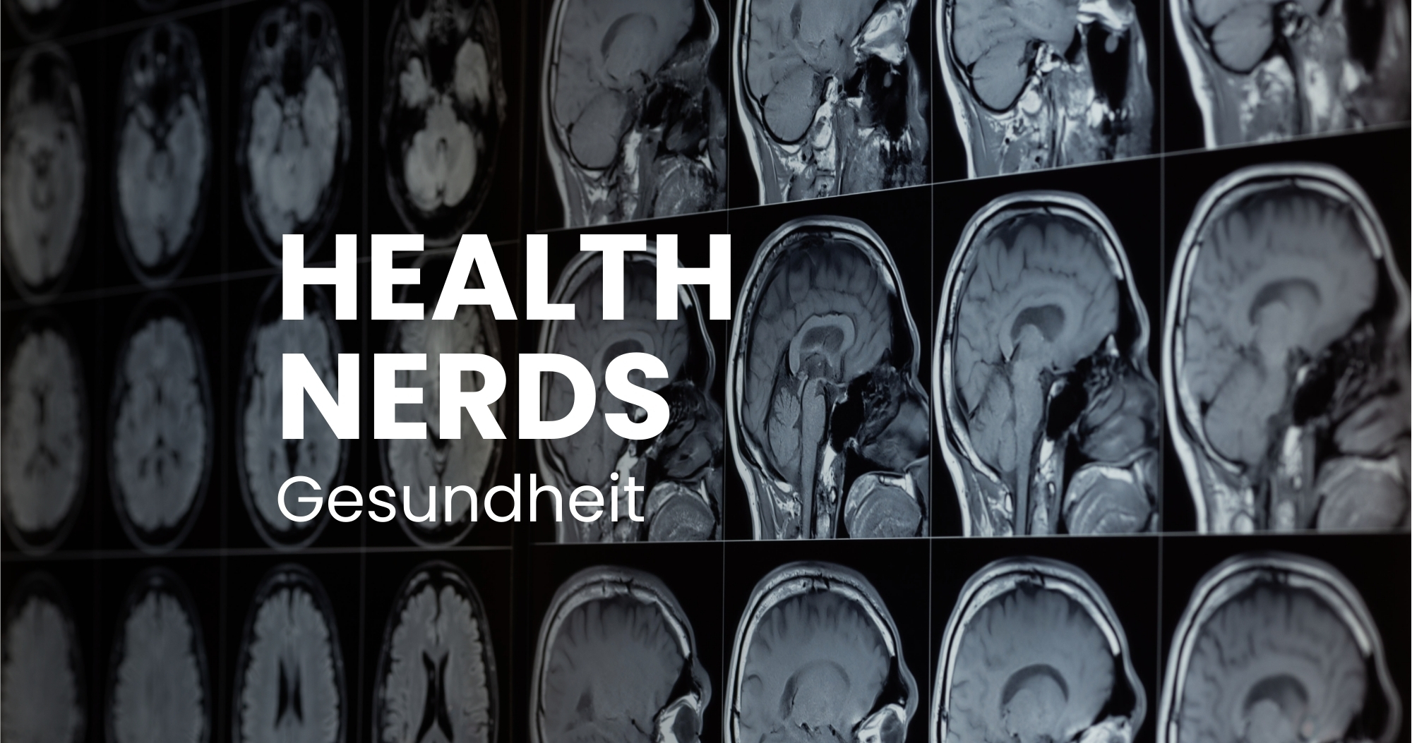 ADHS: Überhypte Diagnose oder gut erforschtes Störungsbild?