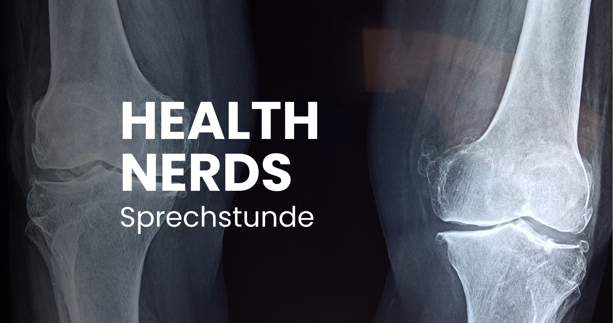 SPRECHSTUNDE: Eure Fragen zu Knochengerüst, Skelettsystem, Gelenkschmerzen und Knochenbrüchen