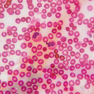 Lactoferrin Immun+ Bild zu Schutz der Zellen vor oxidativem Stress³