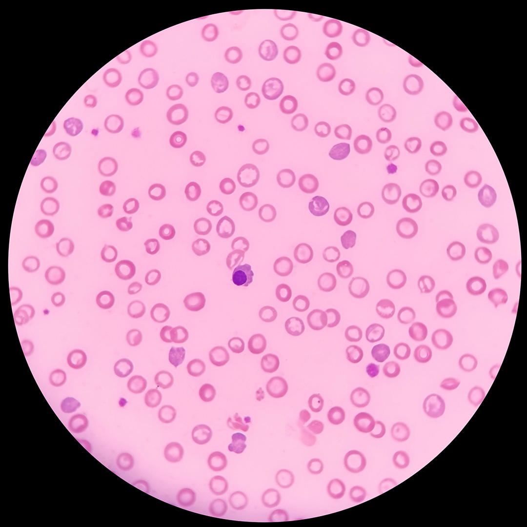 Natural Iron Bild zu Reduction of fatigue*