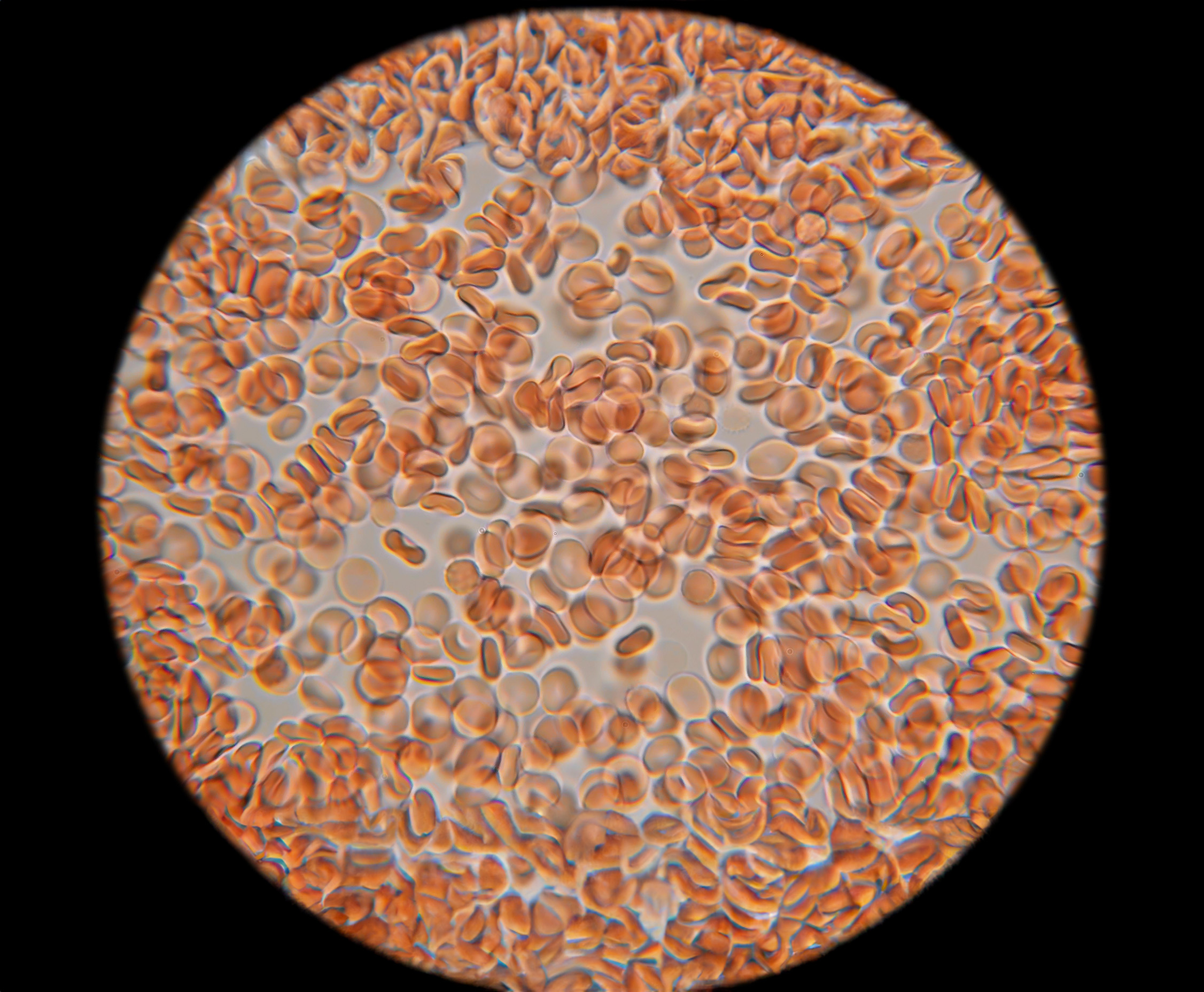 Symbolbild für FAQ zu Natural Iron – Antworten auf deine Fragen