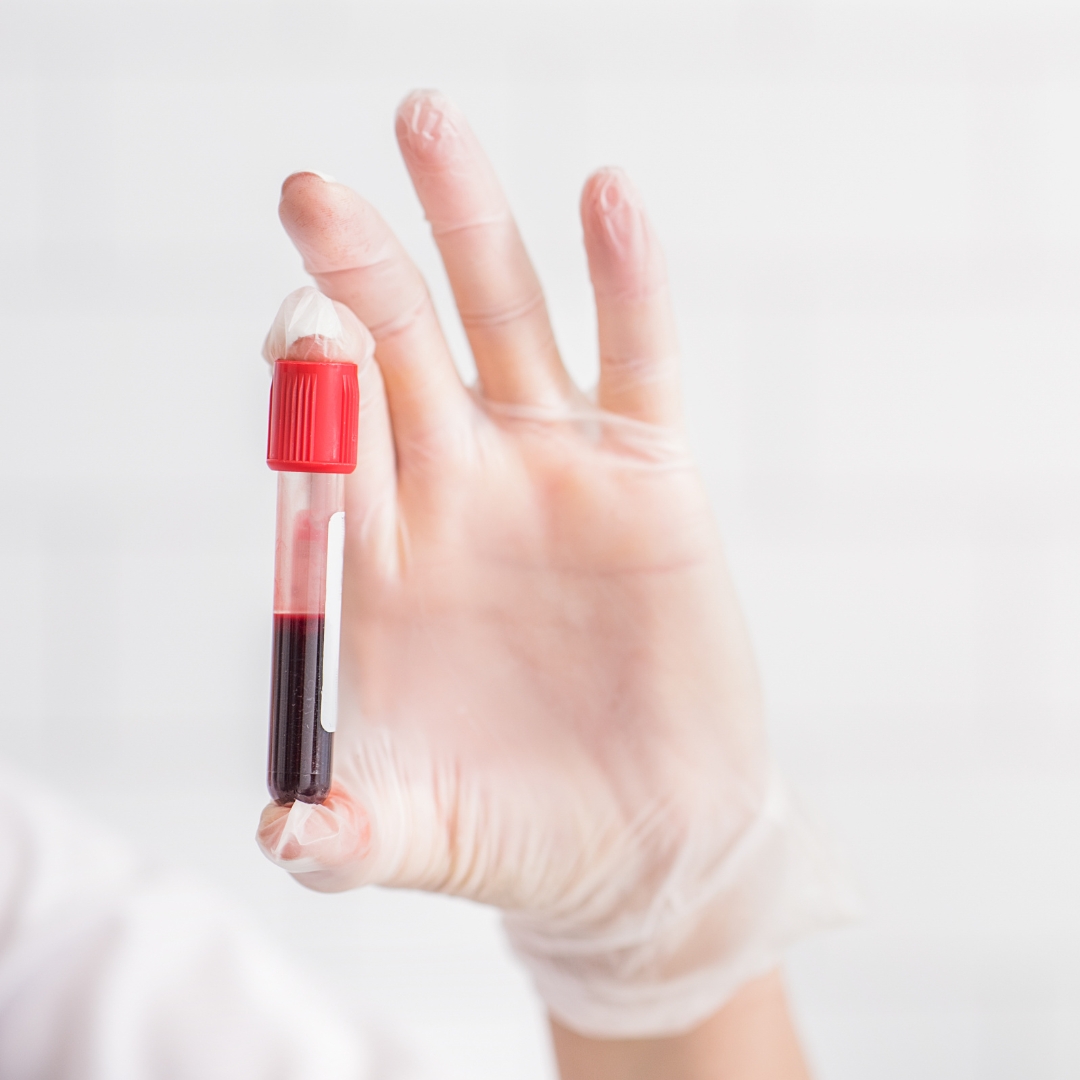 Behandlung von Eisenmangel – Leitfaden für Diagnostik und Therapie